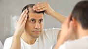 Dealing with Hair Loss: Tips for Men